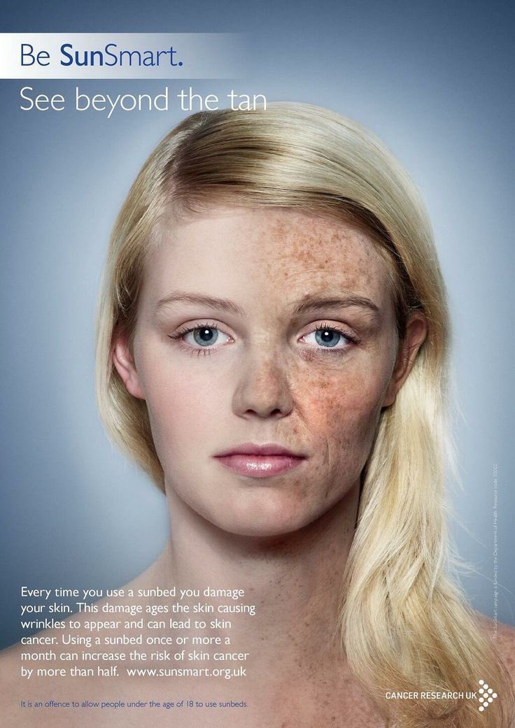 Powerful and true! 
#skin #SkinCancerAwarenessMonth <a href="/CR_UK/">Cancer Research UK</a>