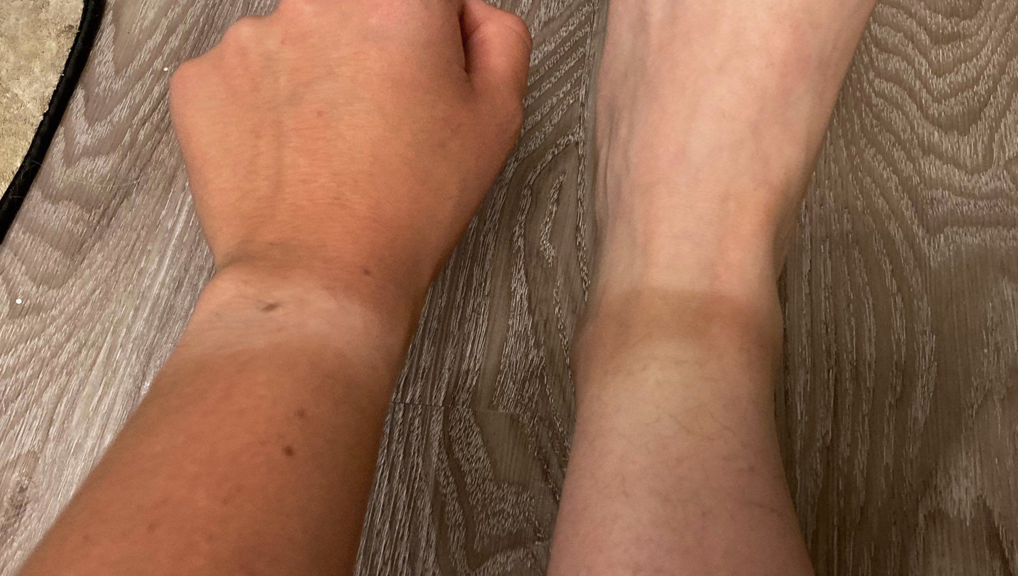 ysa on X this is the stupidest thing ever and not even worth posting but I wanted to show off the fact that the award for the worst watch tan and