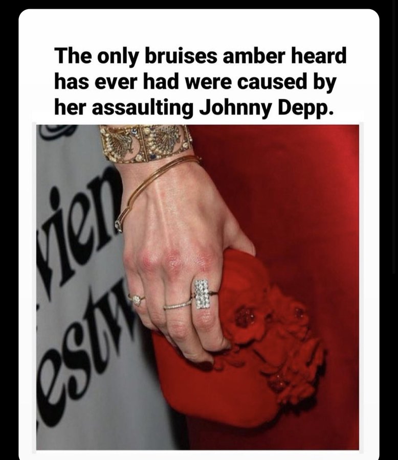 JusticeSquad2's tweet photo. Amber sweety i’m so sorry you had to bruise your knuckles while punching Johnny Depp’s face that must have been so hard for you. 😞 

#IStandWithAmberHeard https://t.co/mwhEUART80