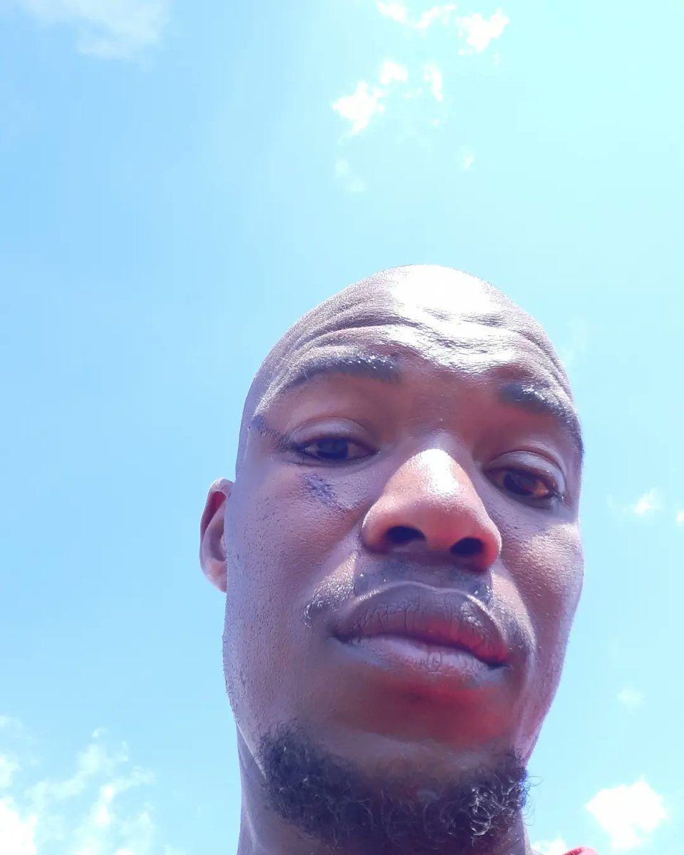 Piet_Masemola's tweet photo. Before is a picture of a wound/Scar I got while playing iswazi. The second picture is the after using @PortiaM_Skin Marula Skin Oil for a week. Magic I tell you.
#PortiaMSkinCare #ShareTheGlow #10YearsOfPortiaM #PlugHimIn
https://t.co/maH0qpA6bV https://t.co/CE0P48FNHg
