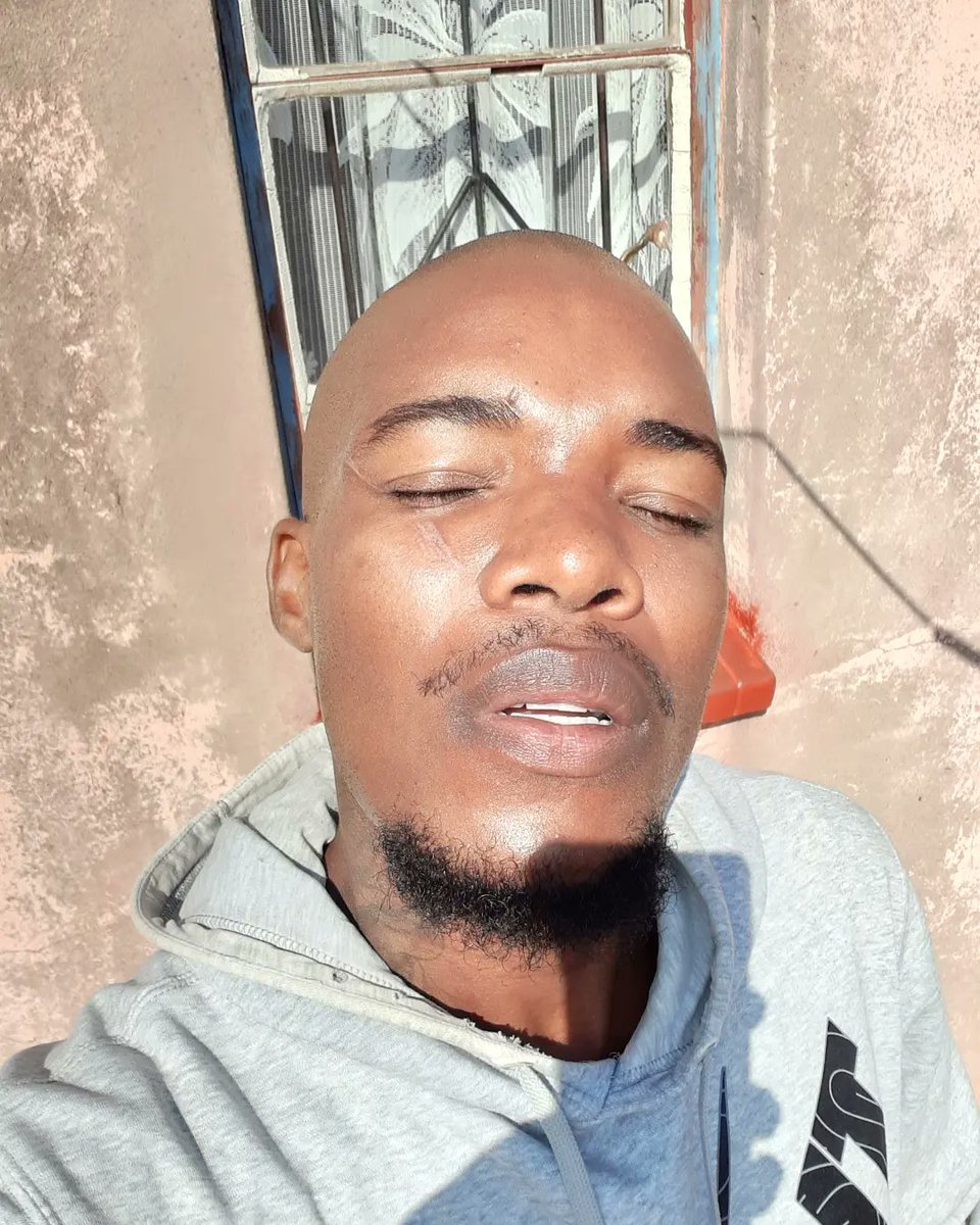 Piet_Masemola's tweet photo. Before is a picture of a wound/Scar I got while playing iswazi. The second picture is the after using @PortiaM_Skin Marula Skin Oil for a week. Magic I tell you.
#PortiaMSkinCare #ShareTheGlow #10YearsOfPortiaM #PlugHimIn
https://t.co/maH0qpA6bV https://t.co/CE0P48FNHg