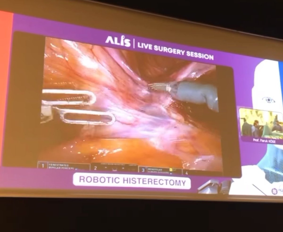We watched the live robotic histerectomy in <a href="/ACUTipKongre/">ALIS (A Look Into Science)</a>, it was a good experiance. Thanks for Prof. Faruk Köse