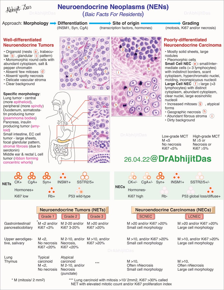 Neuroendocrone neoplasms (NENs): basic facts for residents 

* NET vs NEC
* Morphology

#NeuroendocrineNeoplasms
#MakeSurgiPathEasy