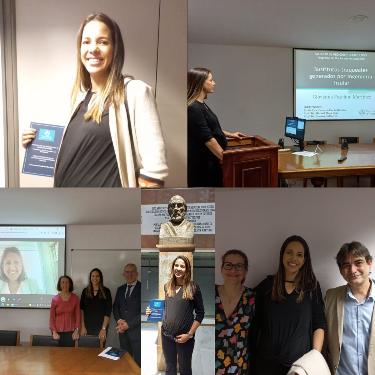 TTrueta's tweet photo. En Cirugía Torácica @TTrueta  del Trueta @htrueta, ahora somos un servicio con el 75% doctores 👏👏👏. Enhorabuena a la Dra Foschini, nuestra más reciente doctoranda. https://t.co/MReZWEpZVn