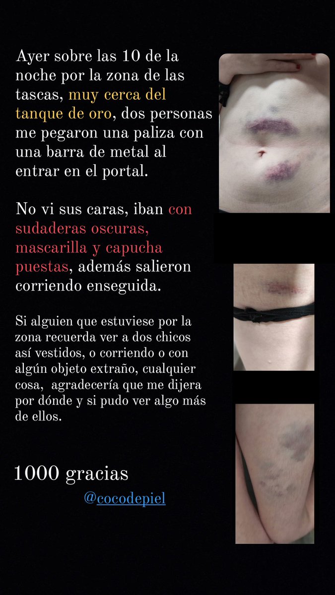 cocotienepiel's tweet photo. Lo subo aquí también por si acaso https://t.co/ftYxqTAaN7