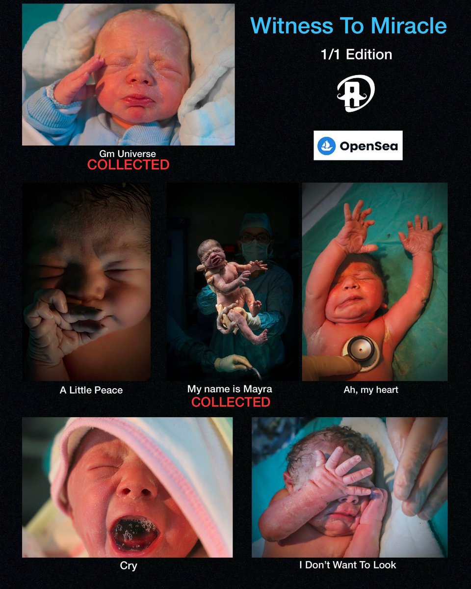 I work as an anesthesia technician at TOGU Hospital
I have been taking professional birth photos since 2016.I don't shoot for commercial purposes.Because I love witnessing miracles and recording these miraculous moments.
#nft #nftcollector #nftphotography 
opensea.io/collection/wit…