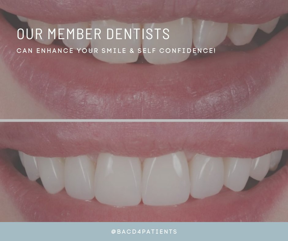 📌 To find your nearest BACD Dentist, message us today! 
#BACDDentist #EthicalCosmeticDentistry