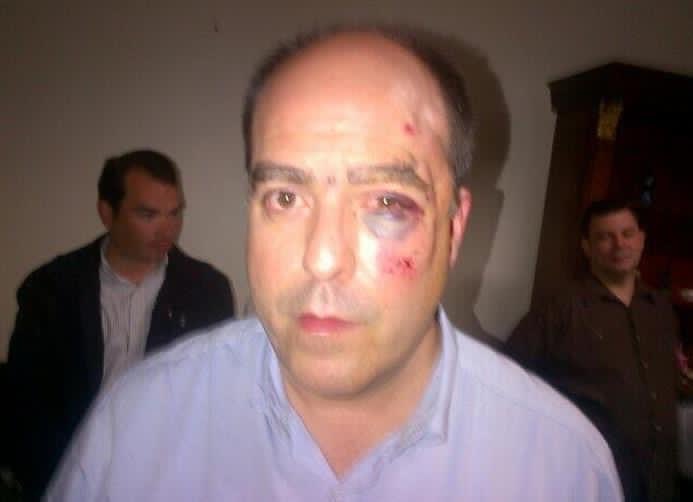 ELOBISPO4's tweet photo. Se filtró Noticia. En Colombia al Asesino de Niño. Julio Borges. Lo atracaron y le dieron una paliza. Que opinas. Será Falso Positivo. Para llamar la atención. https://t.co/GMjdyyvDzB
