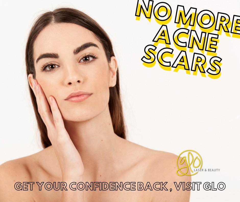 GloBeautySA's tweet photo. What Scar? 

Our Cleopatra Glo treatment will reduce the appearance of scars in no-time.

#byebye #byescars #nomore_scars https://t.co/v74uhyHrfX