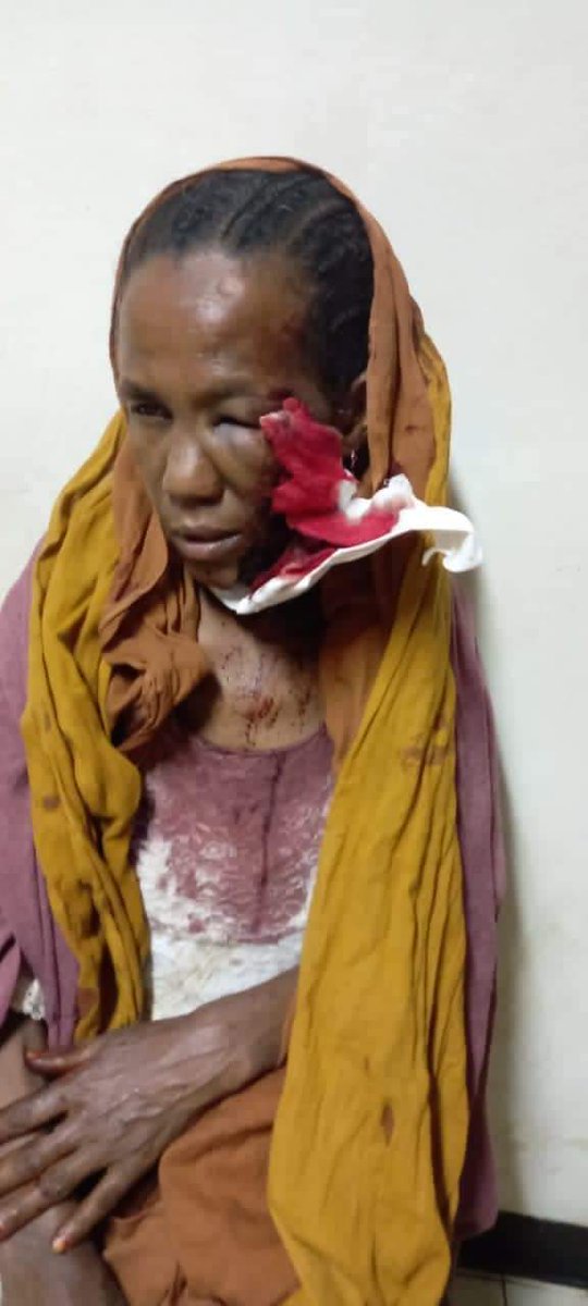 fitih_'s tweet photo. Eyewitnesses of #GondarMassacre reported that regional security forces &amp; militias were also perpetrators of the massacre rather than defending innocents. We demand speedy independent investigations &amp; a non-delayed Justice!

 #IslamophobiaInEthiopia

@Amnesty @hrw @StateDept https://t.co/DLG5z7SYth