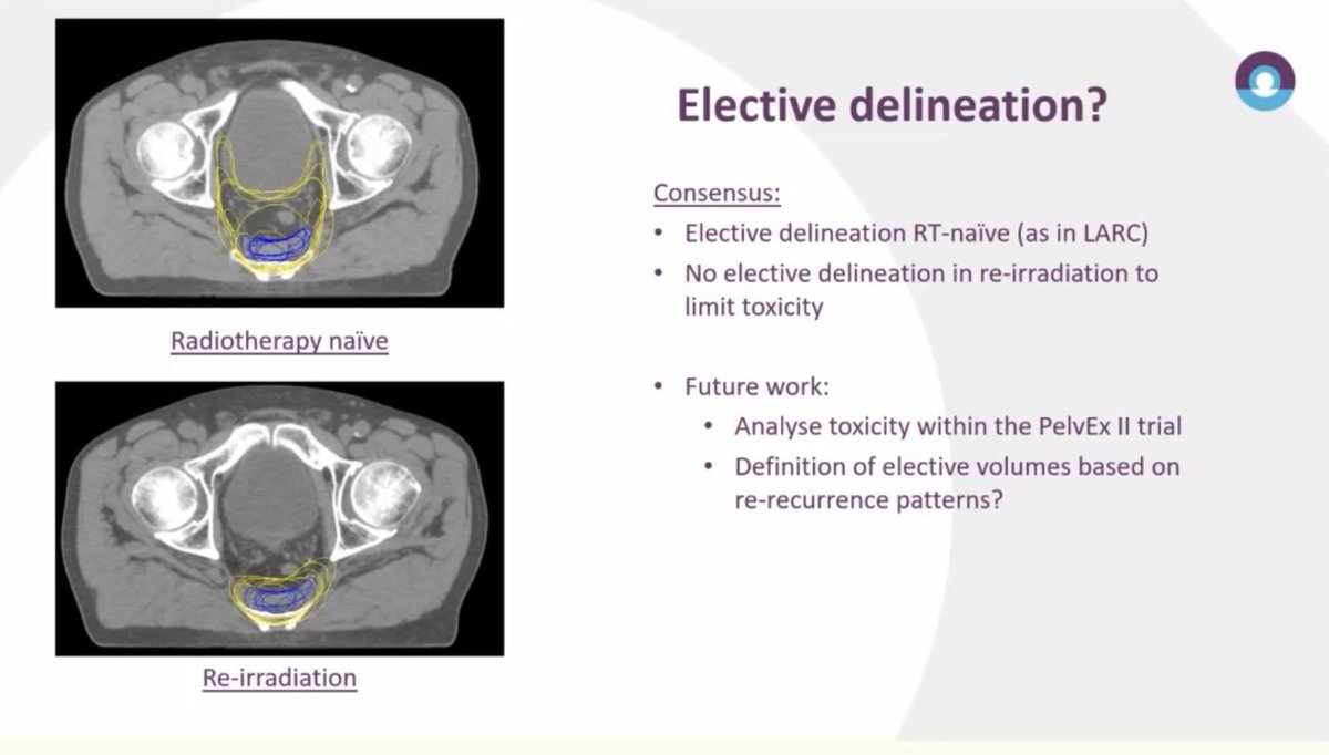 Standardising target volumes for RT for locally recurrent #rectalcancer seems an almost impossible task, so I’m full of admiration for Floor Piquer for even trying.
Particularly important points re: risk adaptation dependent on
- surgical plan
- previous RT
#ESTRO2022 #radonc