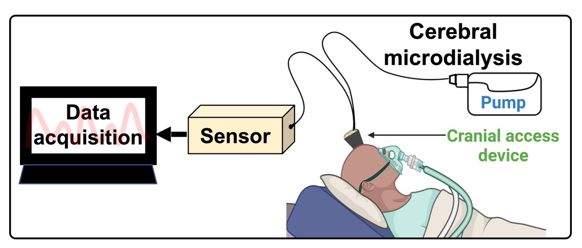 HutterTanya's tweet image. Our recent paper “Monitoring Neurochemistry in Traumatic Brain Injury Patients Using Microdialysis Integrated with Biosensors: A Review” is open access!
lnkd.in/gisPEqGM
#TBI #neuroscience
@CamNeurochem @farahalimagham @Cambridge_Uni
@CockrellSchool @utmechengr @HutterLab