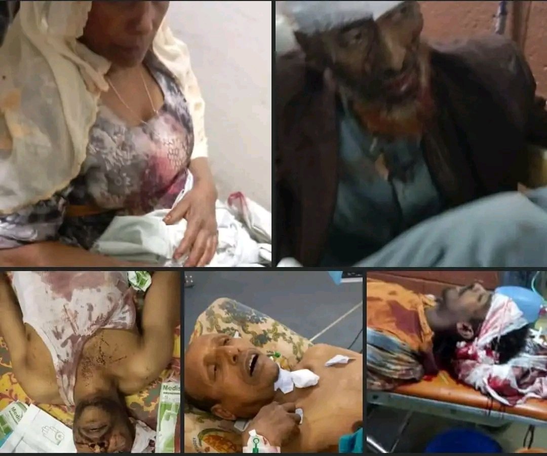 ጎንደር የዲንጋይ ሀገር!!