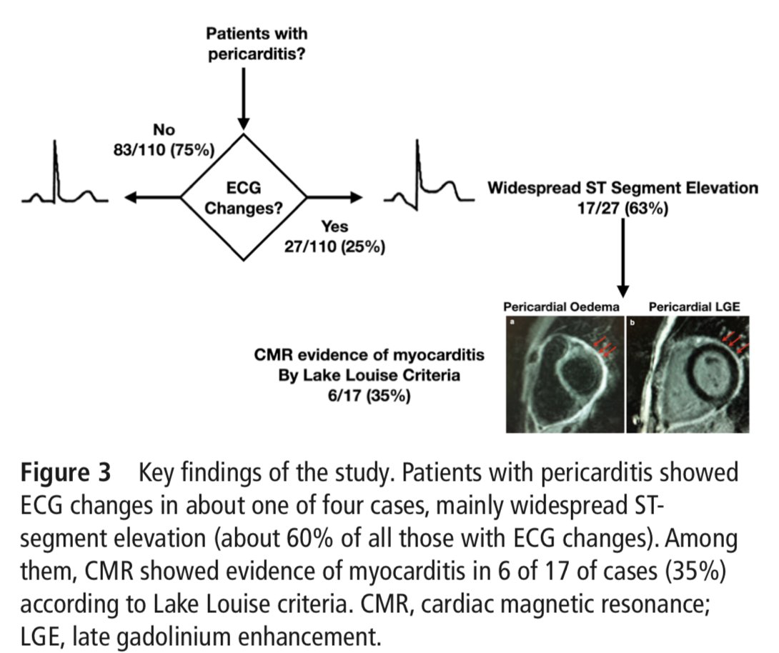 Edgardo Alania (@ed_alania) on Twitter photo 🟢Diagnostic & prognostic role of the electrocardiogram in patients with pericarditis <a href="/Heart_BMJ/">Heart_BMJ</a> <a href="/ImazioMassimo/">Massimo Imazio</a> <a href="/MiMillesimo/">Michele Millesimo</a> #CardioEd #Cardiology #CardioTwitter <a href="/ecgrhythms/">Arnel Carmona</a> <a href="/GiuseppeGalati_/">Giuseppe Galati</a> <a href="/APCyCCV/">Archivos Peruanos Cardiología y Cirugía Cardiovasc</a>
📂LINK⬇️
heart.bmj.com/content/early/… 🟢Diagnostic & prognostic role of the electrocardiogram in patients with pericarditis <a href="/Heart_BMJ/">Heart_BMJ</a> <a href="/ImazioMassimo/">Massimo Imazio</a> <a href="/MiMillesimo/">Michele Millesimo</a> #CardioEd #Cardiology #CardioTwitter <a href="/ecgrhythms/">Arnel Carmona</a> <a href="/GiuseppeGalati_/">Giuseppe Galati</a> <a href="/APCyCCV/">Archivos Peruanos Cardiología y Cirugía Cardiovasc</a>
📂LINK⬇️
heart.bmj.com/content/early/…