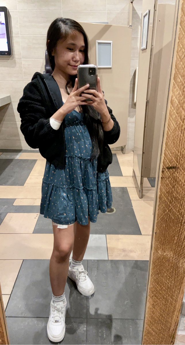 ikuurs's tweet photo. i don’t normally wear dresses but when i do i guess it’s kinda cute
(the pads are there because i was clumsy and got scalded🤕) https://t.co/744YJf2LbA