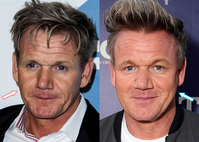 Celebrity chef Gordon Ramsay is not only famous for his culinary talents, he also has a reputation for having a fiery personality.
So it wasn’t long before the public scrutinized Gordon’s looks. Every time he started shouting and swearing in the kitchen,
https://t.co/DwrB56f1rp https://t.co/gJFoOrgBrF