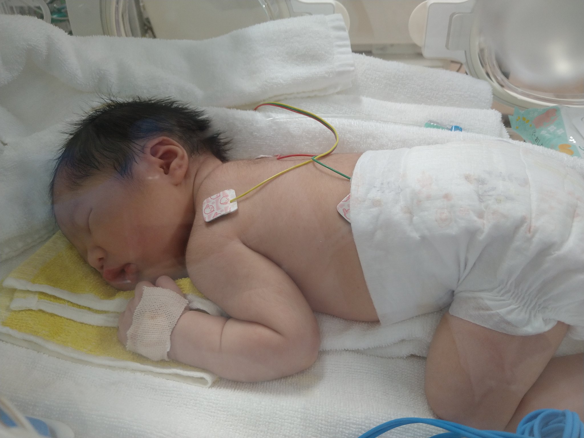 新生児無呼吸発作 Twitter Search Twitter