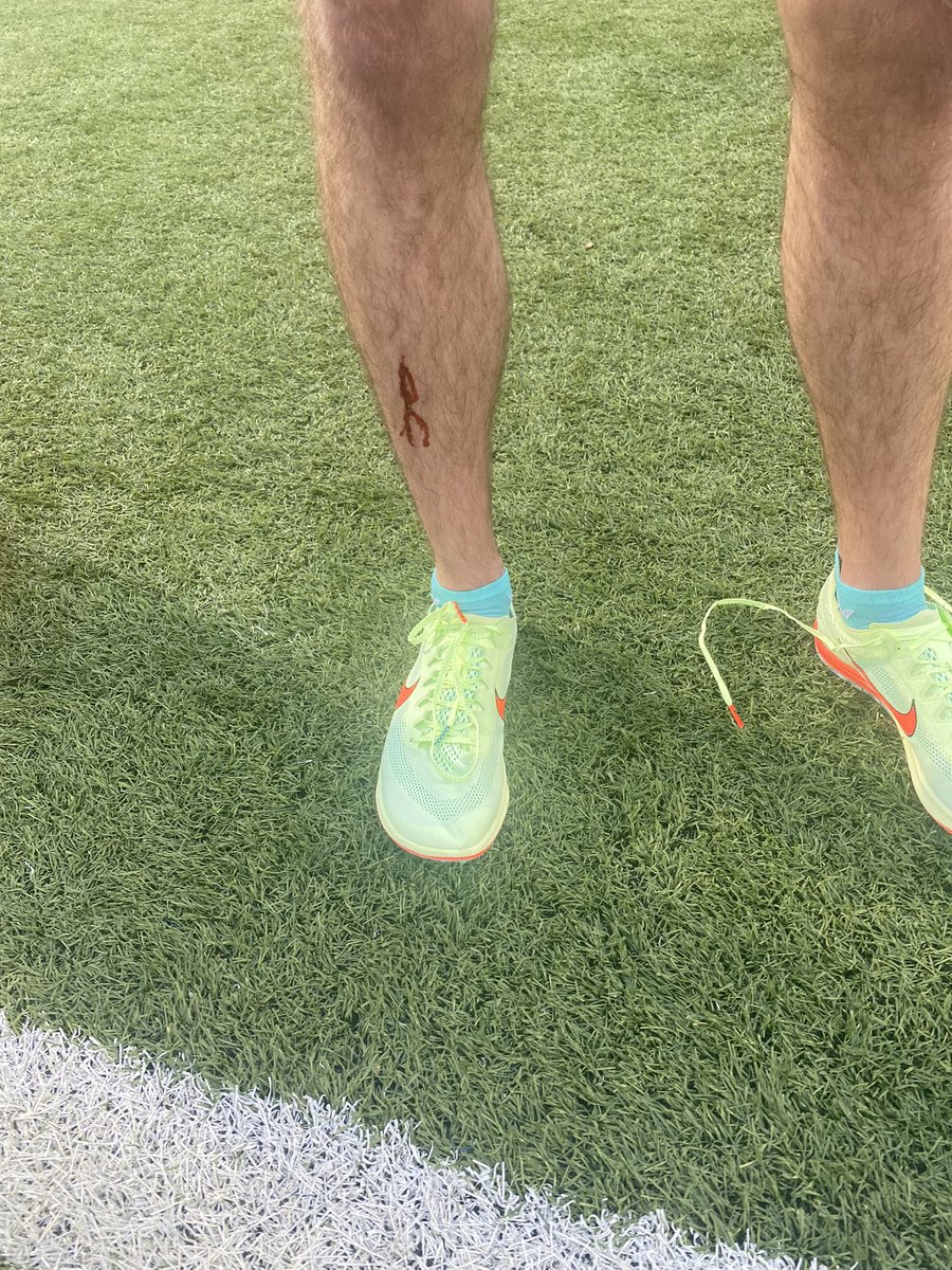 ephstfxc's tweet photo. @elitherunnerguy qualifies for state in the 3200 with a new PR! @AthleticsEP  He gets to leave with a battle scar too! https://t.co/IVwRav4fNR