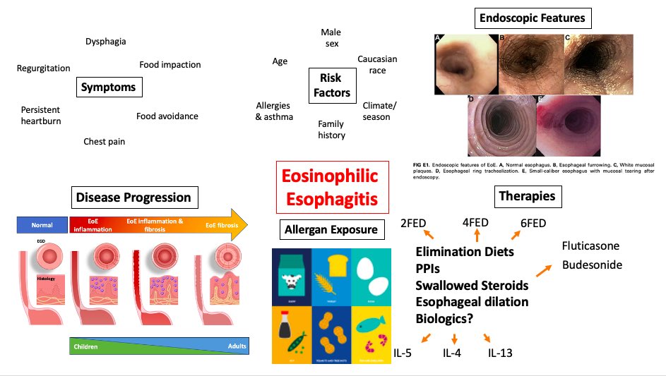 #medtwitter Our illness script on eosinophilic esophagitis! If you haven’t watched <a href="/JimCallaway7/">James Callaway</a> talk about EoE yet, follow the link below! youtu.be/ruwnNuYEVMY
