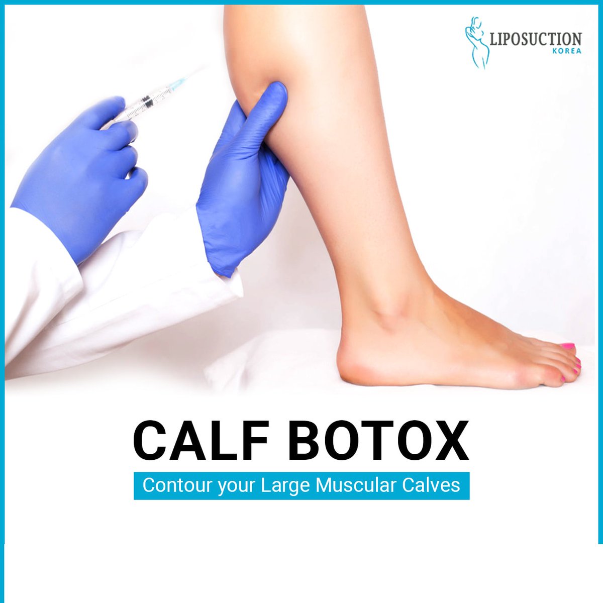 liposuctionkr's tweet photo. Calf Botox💟
The reason it works so fast is because the toxin is injected directly into your calf muscle, paralyzing certain nerves and preventing them from contracting fully.
Consult👇
Email at📩: info@liposuctionkorea.com
https://t.co/T0mfTvR1IW
Inbox https://t.co/RaR0IM0BPf https://t.co/DQ8FHrLbOg
