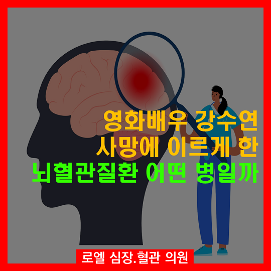 안타까운 상황이라 궁금했습니다. 뇌혈관질환!! <영화배우 강수연 사망에 이르게 한 #뇌혈관질환 어떤 병일까> #심장혈관전문의 #로엘의원 #뇌졸중  naver.me/5jY16Wh2