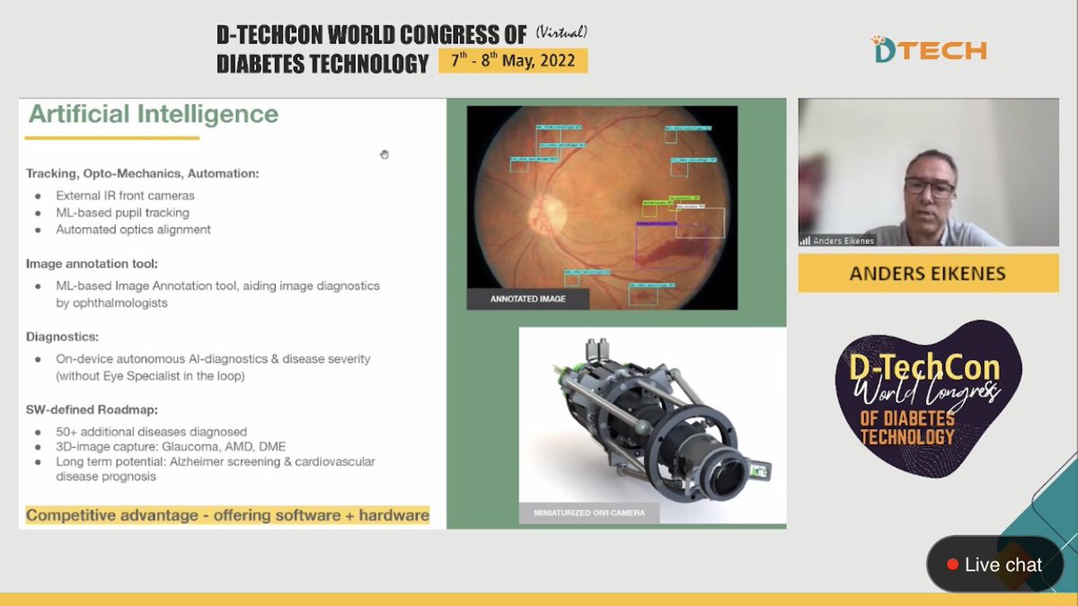 DTechCon's tweet photo. Anders Eikenes Talked at DtechCon2022 about Role of AI in diagnosing Diabetic Retinopathy
Moderated By: Tushar Anil Sadhu
Chaired by: Dr. Amit Gupta & Dr. Ami Sanghvi @dramitaol @dramisanghvi
Attend Live: https://t.co/JCIjHVho63
#Dtech #DtechCon2022 https://t.co/ArTZEIbSBZ