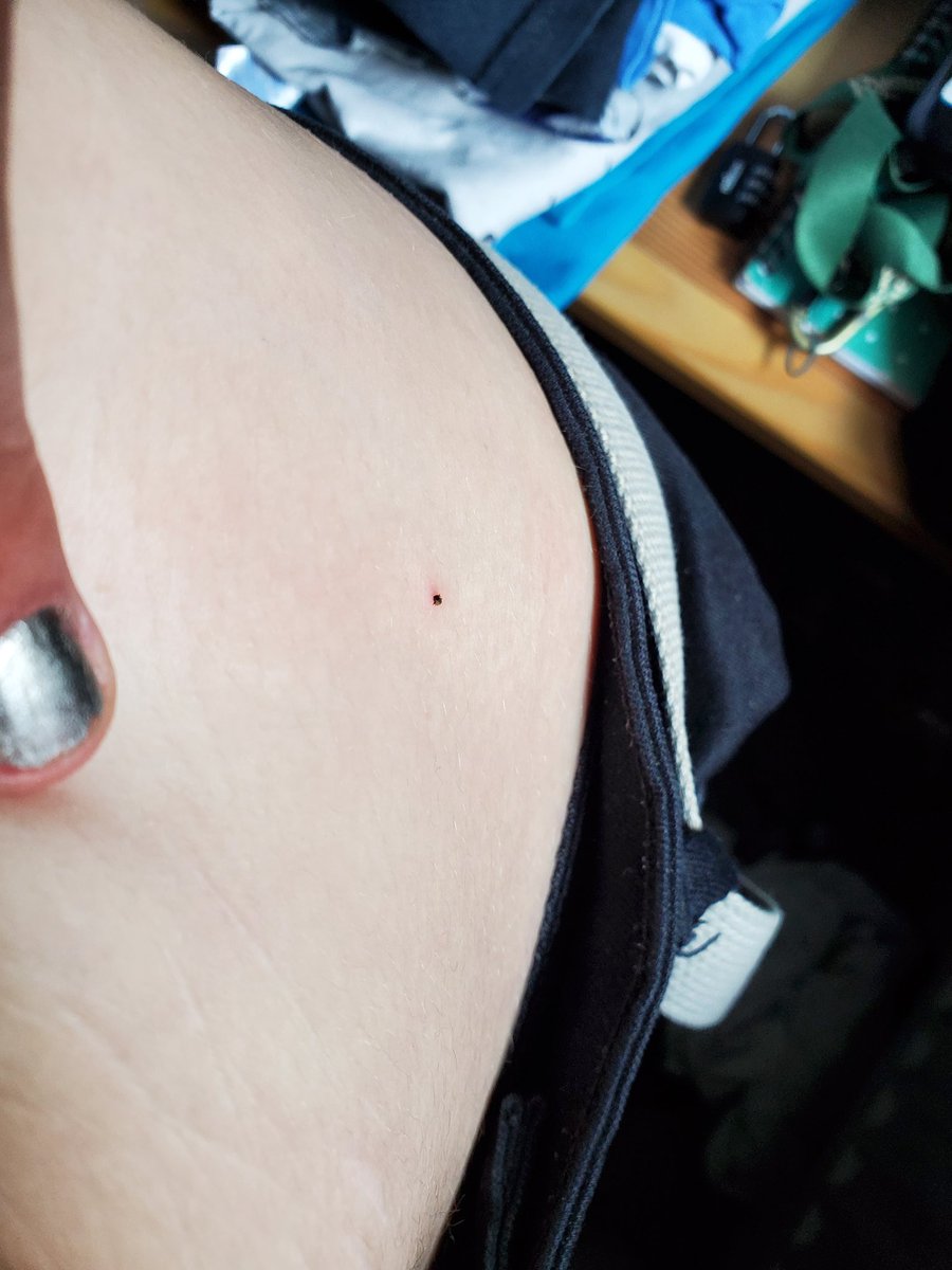 NaturNaomi's tweet photo. Ah shit. I brought home a tiny passenger 🤦♂️ #CheckForTicks https://t.co/hJqEIaCR5u