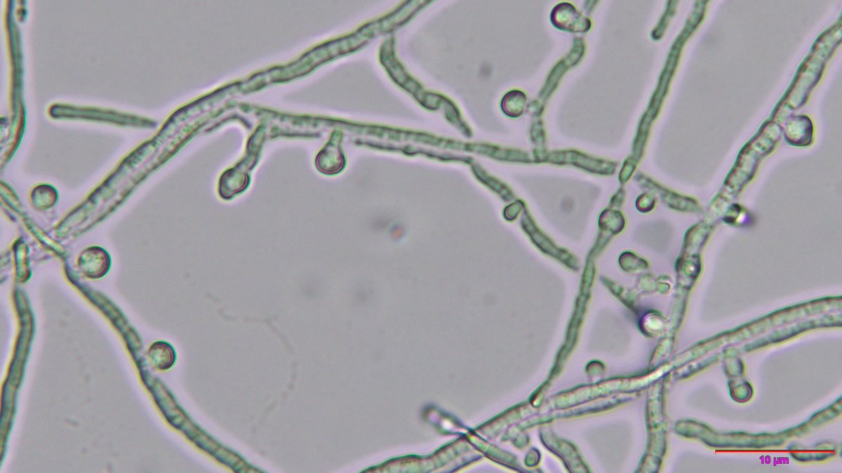 xmsunxhp's tweet photo. Emergomyces pasteurianus https://t.co/MhZlAMNNdb