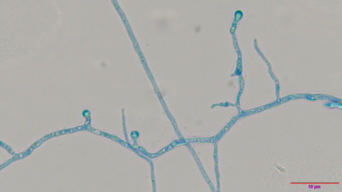 xmsunxhp's tweet photo. Emergomyces pasteurianus https://t.co/MhZlAMNNdb
