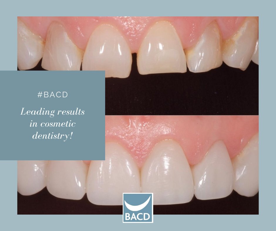 Our Member Dentists provide the highest level of care, quality materials and the latest digital technology to achieve leading results in cosmetic dentistry.  Message us for more information.
#BACDDentist #CosmeticDentistry