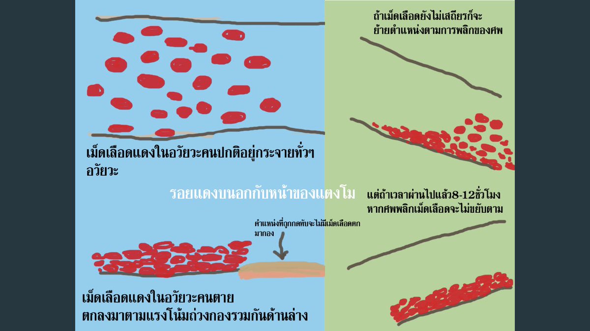 SherLockCoco's tweet photo. 📌 ขอตั้งข้อสังเกต (1.) สังเกตตอนนำร่างตมขึ้นมา ร่างนอนคว่ำและขาทั้ง2ข้างมีลักษณะแข็งเกร็งงอดังรูป (2.) แสดงว่าตมต้องอยู่ในท่าคว่ำหน้าหัวปักขางอชี้ขึ้น (3.)  จะสอดคล้องกับสภาพศพที่อกแดงเหมือนมีเลือดคลั่ง แผล5รูที่หน้าอกอีก ทุกอย่างสอดคล้องลงล็อกเป๊ะ🧐 #แตงโมต้องได้รับความยุติธรรม https://t.co/QUNFzSSVXl