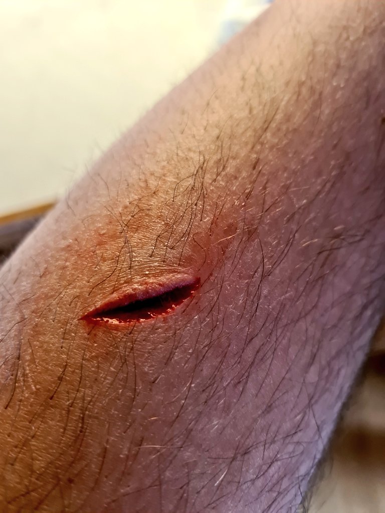 qLimAxzU tweet media