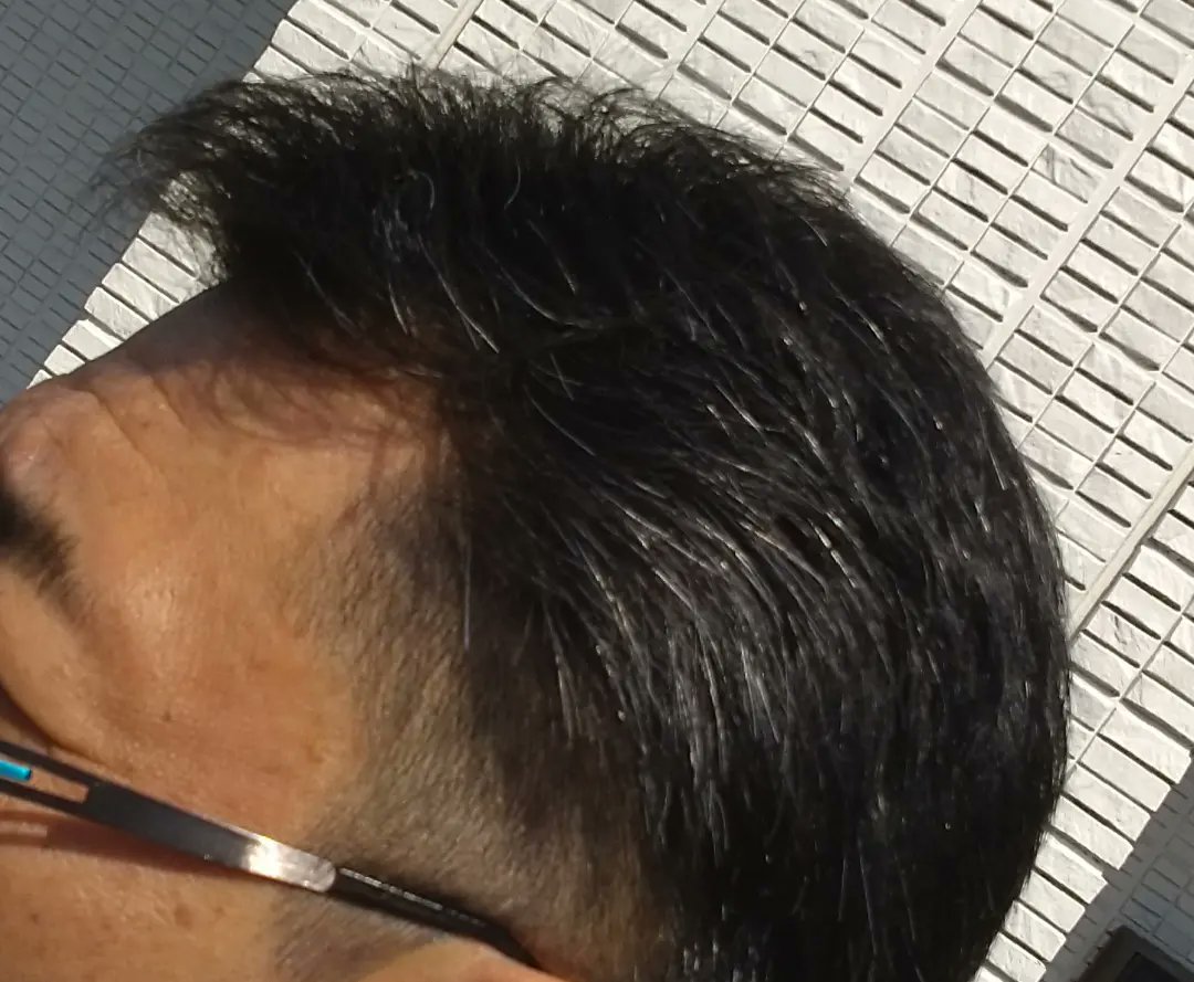 man616161's tweet photo. 20220506_cut!!

髪切りました〜
還暦近いのに2block (^_^;)

暑さ対策を兼ねております〜

薄くもならず…白くもならず…
ありがとう!! 我が頭髪〜🤣

#HairCut #散髪 #2block #暑さ対策 #上を向いて行こう https://t.co/GXjrwmqk3u