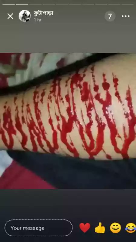 মানুষ কত কস্টো পেলে এই সব কাজ করে কেউ কি বলতে পারবা বাট আমি যে কত কস্টে আছি বলার কিছু নাই।
বাট আমার মনের ভাষা হারিয়ে পেলেছি 
কেউ যদি আমার মনের ভাষা টা বুঝতে চাই তাহলে আমার মন খাল্কা  হবে।
তার উপেক্ষা আছি আমি কেমন।