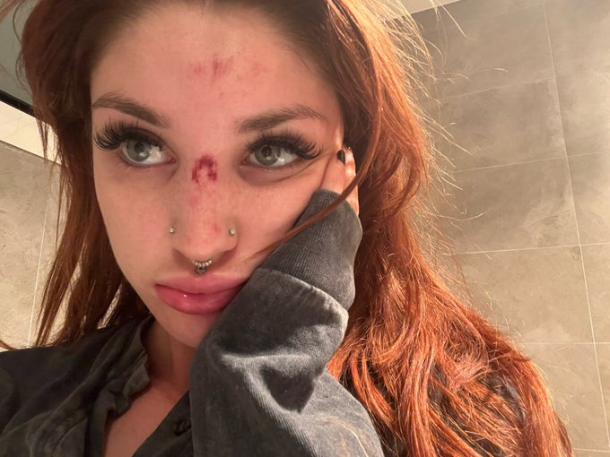 Now I need a forehead kiss for real 😪 https://t.co/iedctU8ARE