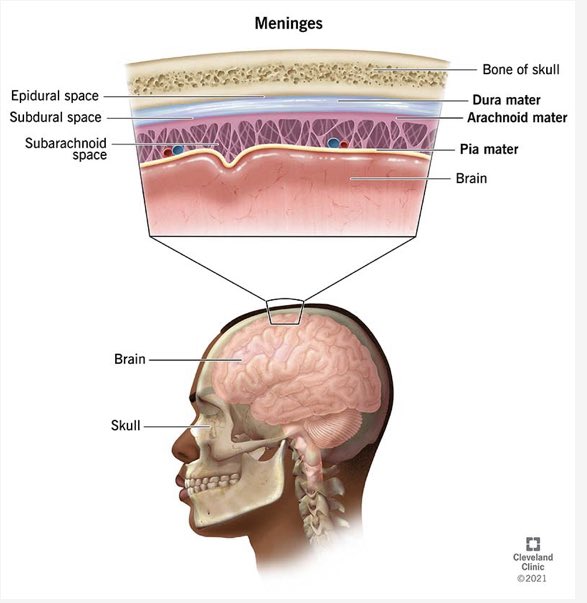 MedTermMatt's tweet photo. MedTerm fun fact MOTHER’S day Ed. There are 3 tissues surrounding your CNS named mother. You can use these to wish a Happy #MothersDay. Use DURA mater if she is a tough mother, PIA mater if she is tender, or ARACHNOID mater if your mom resembles a spider! #MedTerm #HphyUo https://t.co/4RrPghZKFz