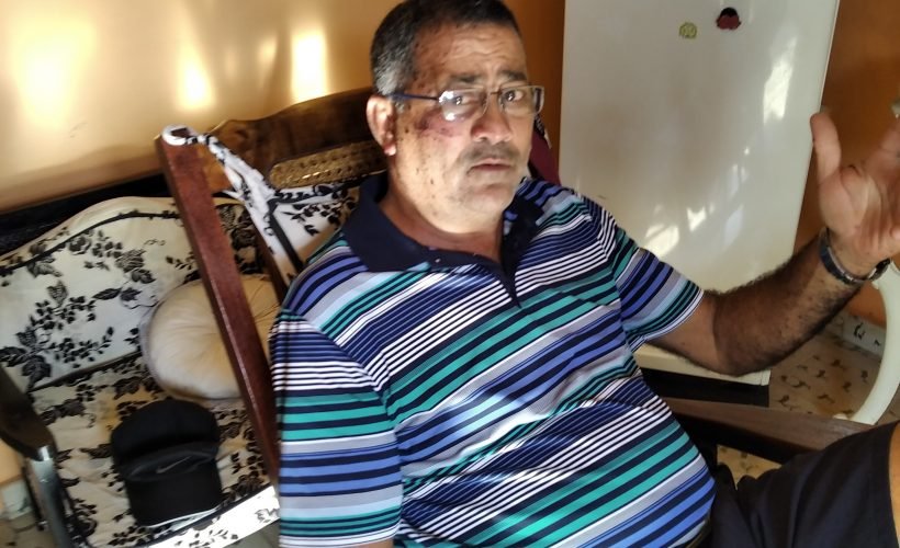 (1-3)“Sentado frente al timón escribía en la hoja de ruta. En el instante de la explosión hablaba por teléfono. De inmediato la guagua volcada", cuenta Francisco Casanova, sobreviviente a la explosión del #HotelSaratoga, quien vive en #Matanzas. #PeriodicoGiron 

Abrimos hilo.