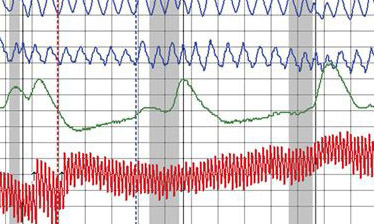 liedetectorguy's tweet photo. Lie detector test in Los Angeles uses a Federal 10-question format that includes 1 to 4 client questions.
https://t.co/6tE6ioqeK0 818 883-6969 https://t.co/rrvvHi1v6I #liedetector #polygraph #liedetectortestinlosangeles #truth #relationship #liedetectorguy https://t.co/tVKsK9oZnR