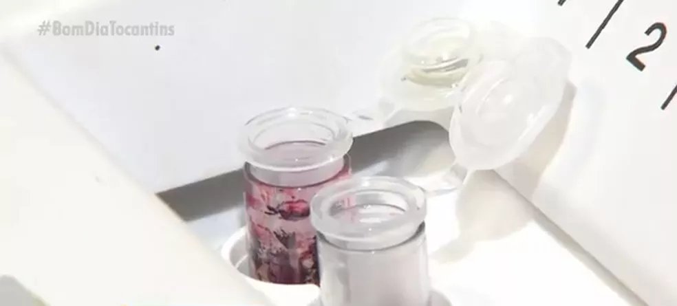 bio_nanda's tweet photo. Projeto monta banco de dados com amostras biológicas de animais do Cerrado Tocantinense
Segue a Thread-
https://t.co/WnsUrMVHnv
#biotwits
@biologianaweb https://t.co/r3PfqI8M5c