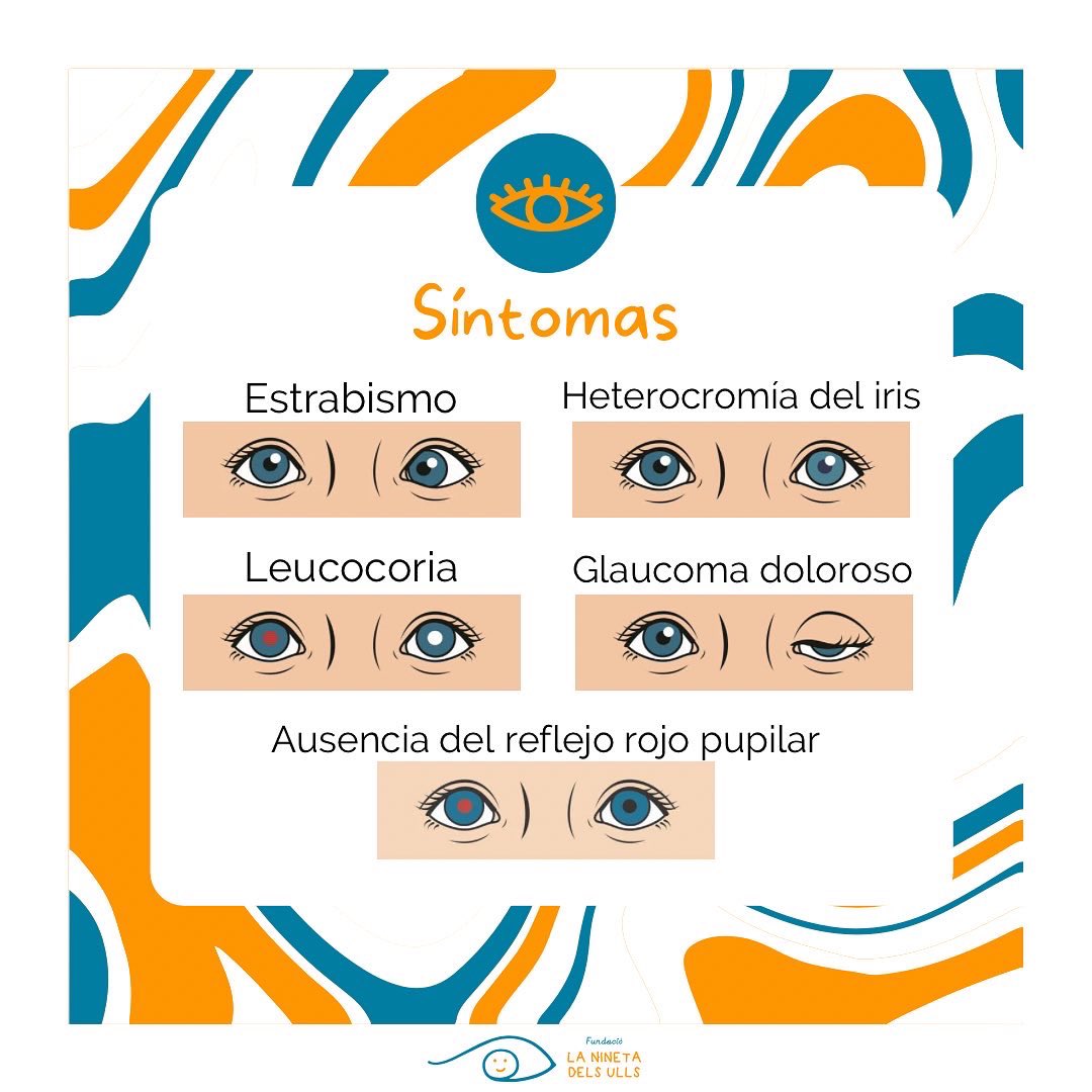 laninetadelsull's tweet photo. 🔸Hoy empieza la semana mundial de concienciación del retinoblastoma👁
🔹Del día 8 al 14 de mayo tenemos la oportunidad de unir fuerzas para difundir información sobre este cáncer ocular.
#WorldRBWeek #RBWeek https://t.co/MDD66OQUxm