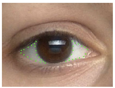 PsychoSchmitt's tweet photo. A Novel Human Sex Difference: Male Sclera Are Redder and Yellower than Female Sclera...older sclera appear yellower, redder, slightly darker than younger sclera...when sclera manipulated to appear redder and yellower, faces perceived as more masculine https://t.co/NzFGFKYmK8 https://t.co/kVFgfAiq0d