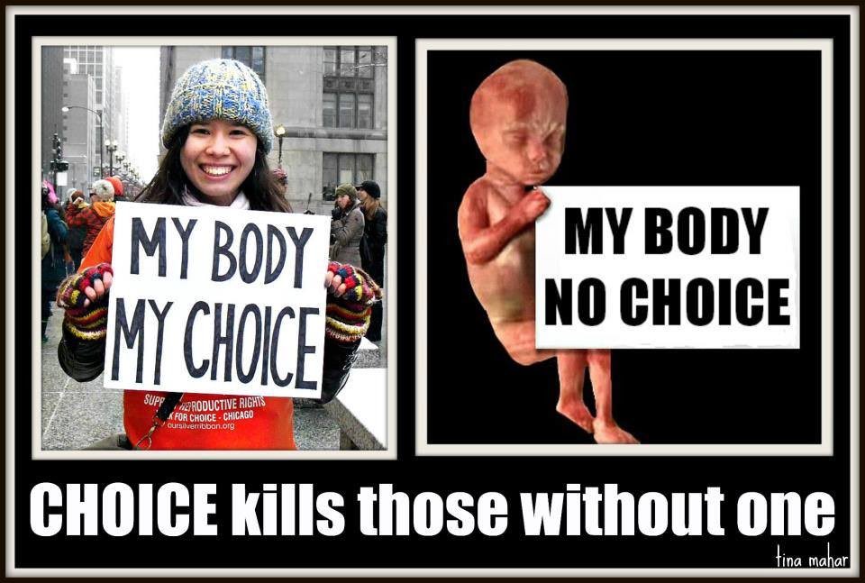 hubbyinsultsme's tweet photo. Equal choice for unborn babies!
#uniqueDNA #momentofconception #probabyschoice #ProLife #allchildrenmatter #Equality #asalways #FJB https://t.co/rGbll5IZgH