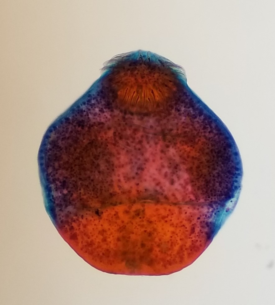 sheltigurl's tweet photo. So, I was looking through old pictures and I found this interesting slide. It's from a liver abscess/cyst and pathology wanted our review. I've only ever seen it this one time so I thought I'd share! #Clinmicro #parasitology #microbiology #medicallab https://t.co/jcQw9HP8Fi