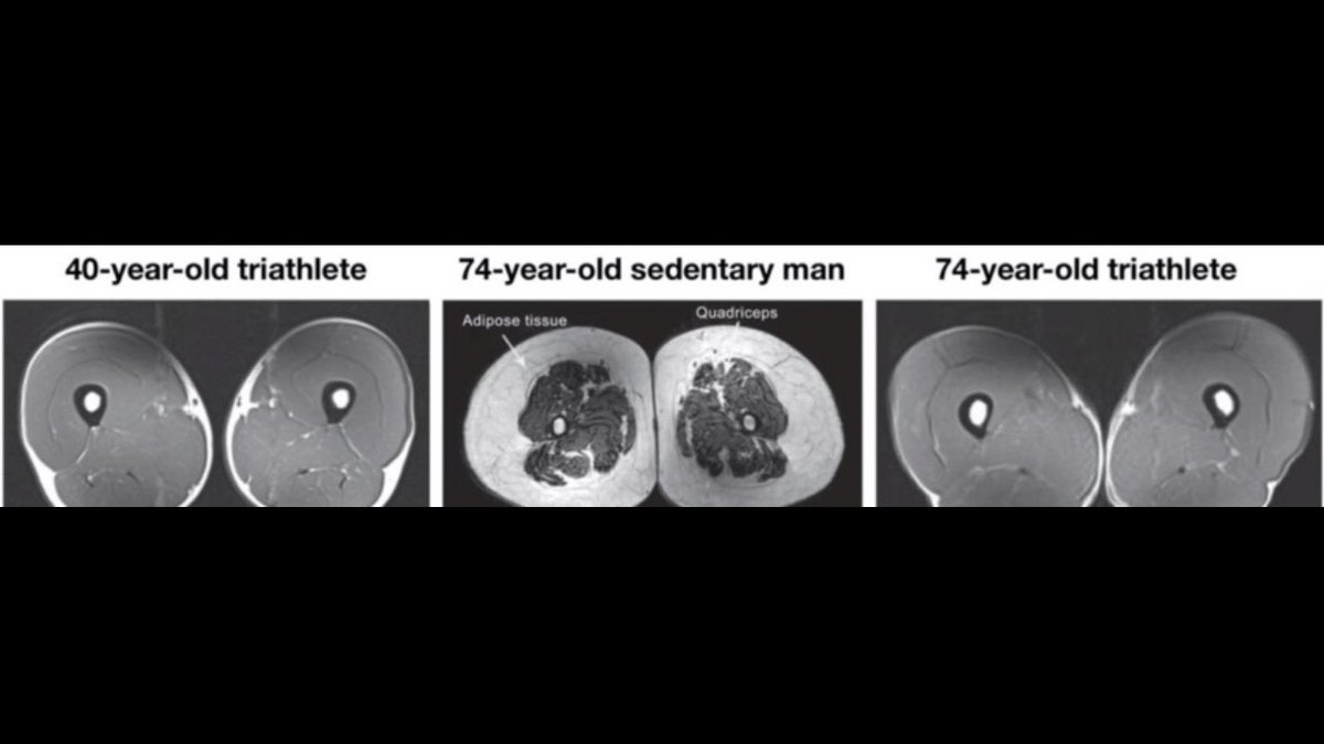 SquatUniversity's tweet photo. The “fountain of youth” isn’t something you can buy. Rather, it’s simply living a physically active life through fitness. https://t.co/Oufvbe5txX
