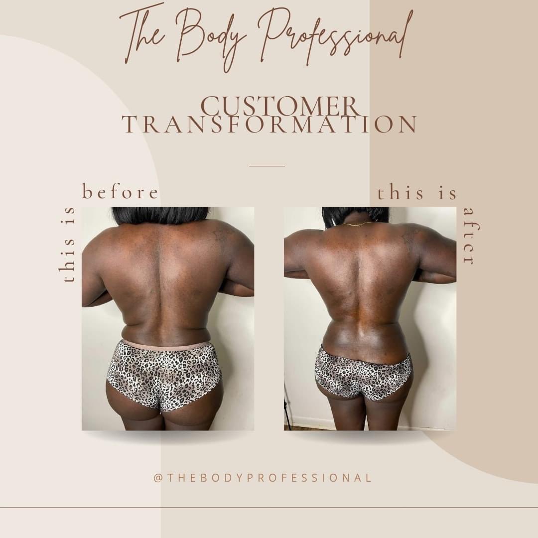 TheBodyPro_'s tweet photo. These are results from just one 90 minute session 🙌🏾🎉👌🏾😍 #atl #MothersDay #noninvasivebodycontouring #bodysculpting #bodysculptingspecialist #bodycontouring #radiofrequency #radiofrequencyskintightening #40kcavitation #woodtherapy #atlantaspa #atlantapersonaltrainer https://t.co/NuG87vwAqp