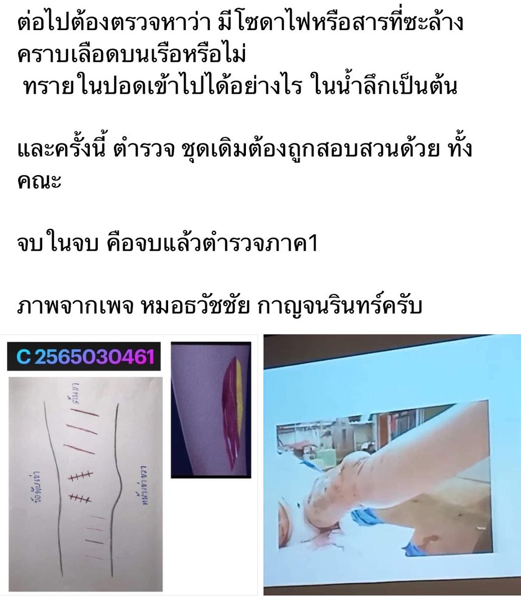 i5junk's tweet photo. พี่จอย คือ1ในนักข่าวที่เชียวชาญด้านไขคดีฆาตกรรมและการสืบสวนสอบสวน ยังระบุเลยว่า หลักฐานของอัจฉริยะวันนี้ถือเป็นการรื้อกระบวนการสอบสวนคดีใหม่ทั้งหมด ที่ผ่านมา3เดือนถือว่าเป็นศูนย์ !! และการนำศพมาสร้างแผลใหม่ เรียกว่าเป็น หมอหลอกหมอ ..อิดก สุดจัดจริงๆ  #แตงโมต้องได้รับความยุติธรรม https://t.co/HRqocXdepl