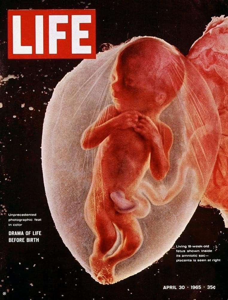 PamelaPutnam's tweet photo. Amazing photo of 18 week old baby in utero #ProLife #OverturnRoe #protectbabies https://t.co/5EuTtOTgV0