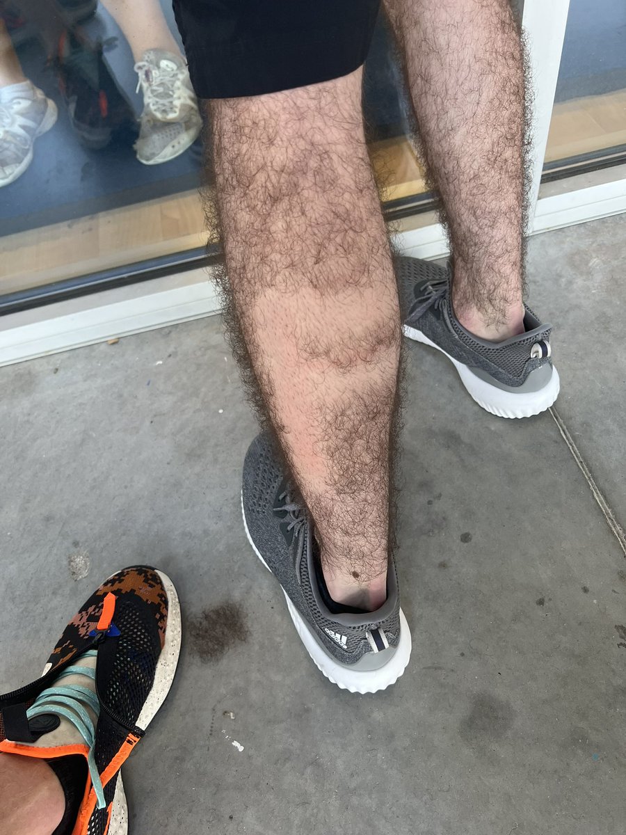 JustinRobinson0's tweet image. It’s the patch of hair on the ground for me