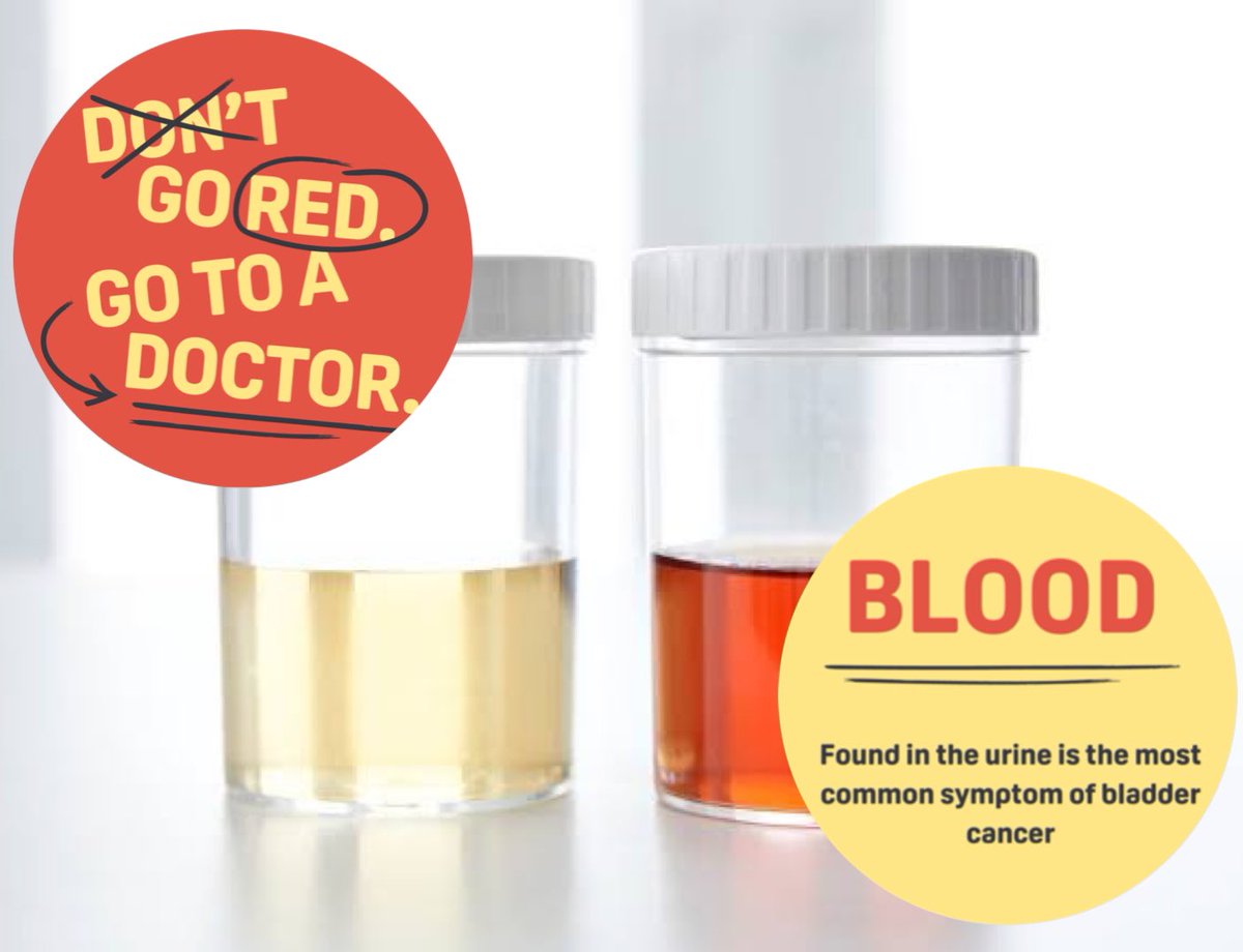bca_australia's tweet photo. 🩸 in your urine is the most common symptom of #BladderCancer. If you ever notice it, #DontGoRed, Go to a Doctor! 
Did you experience any other symptoms? 🧐  #BladderCancerMonth22 #DontGoRed https://t.co/BfrKLfKSKa