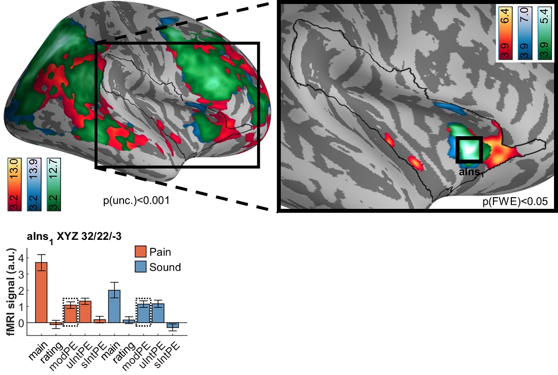 PLOSBiology's tweet photo. .@BjornHoring & @C_Buchel show that the posterior #insula encodes signed intensity #PredictionErrors for pain but not sound, whereas unsigned intensity & modality prediction errors are encoded in the anterior insula for both modalities #PLOSBiology https://t.co/ulXaW6Ykou https://t.co/X1bwEFbeUJ